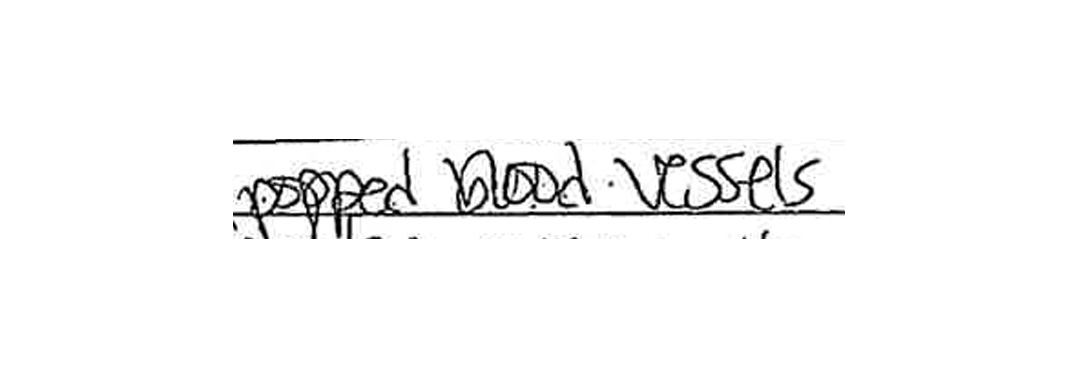 Handwritten excerpt from CB's filing for Domestic Protective Order against Fabialbert Rodriguez. Handwritten text reads: "popped blood vessels"